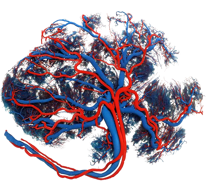 Plazenta Plastination